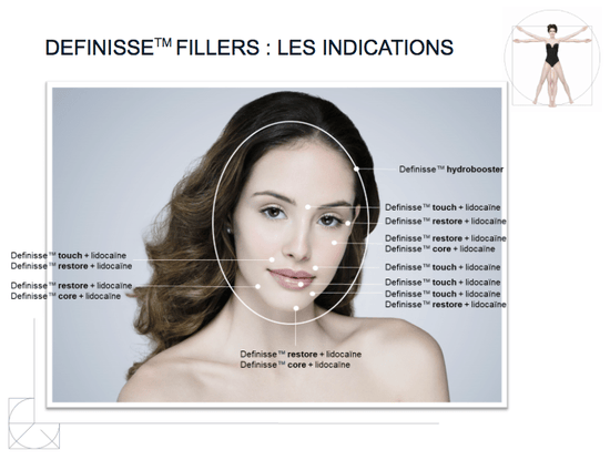 Definisse Core Filler Lidocaïne - Relife Relife Ovale du visage